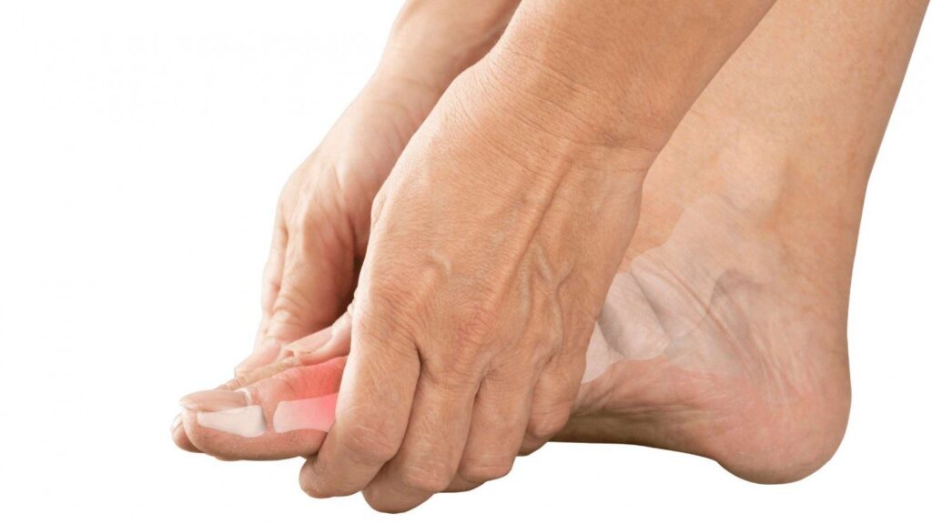 hand holding foot with osteoarthritis