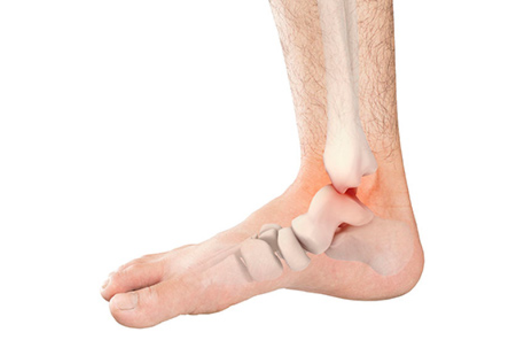 foot illustration