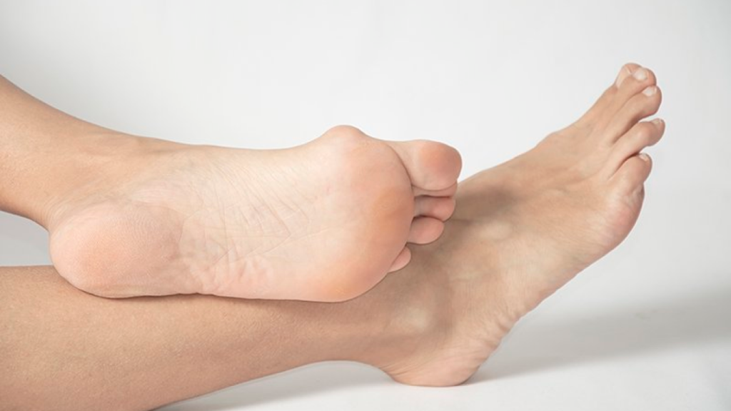 woman's foot with bunion