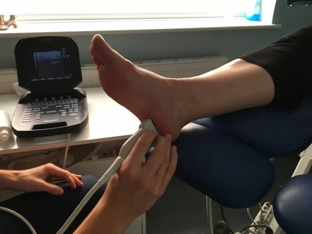 Plantar Fasciitis