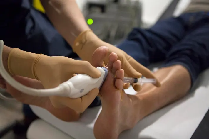 A surgeon operates on a patient who has a Morton neuroma.