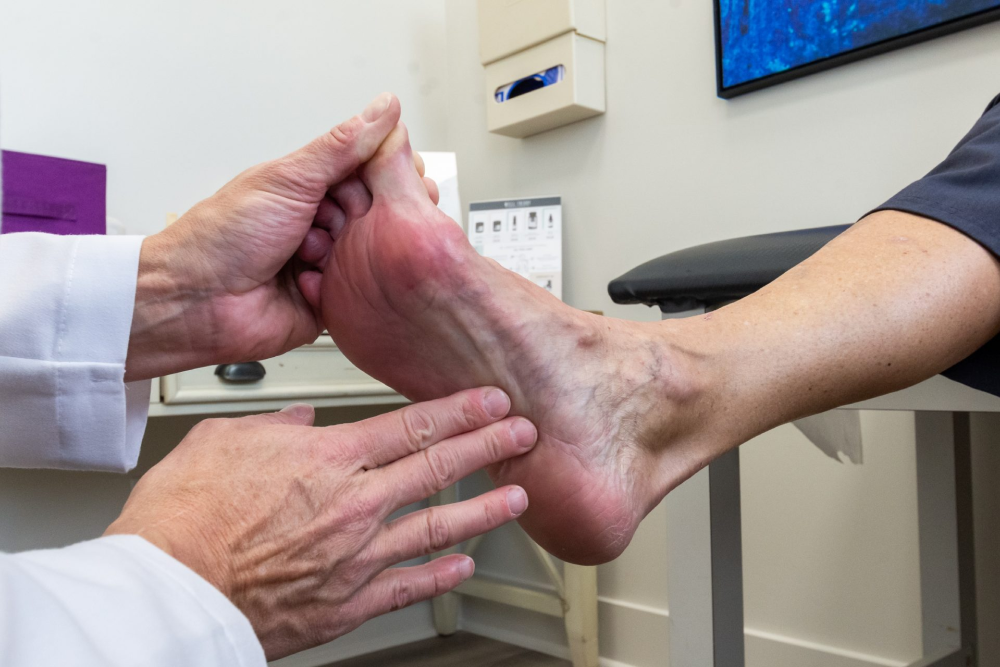 doctor examine a foot with varicose veins