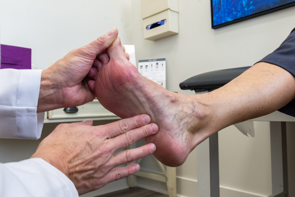 foot with varicose veins