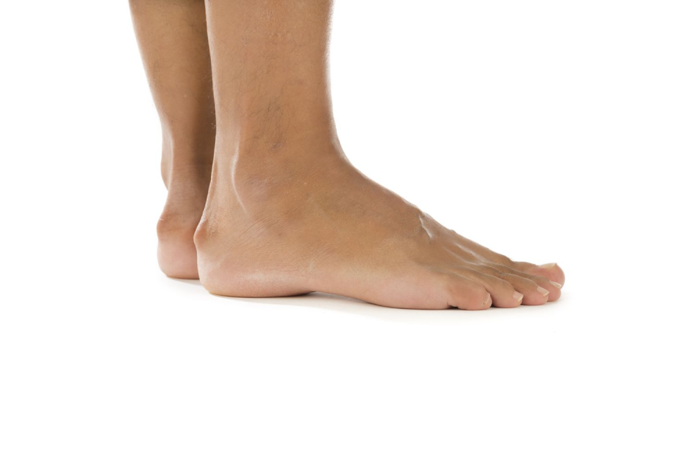 foot with soft tissue at the back