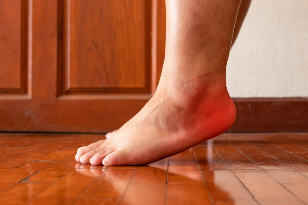 One foot is swollen due to the illness plantar fasciitis.