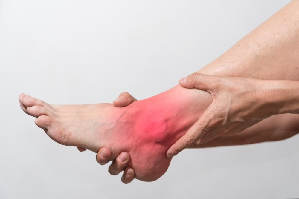 ankle joint arthritis