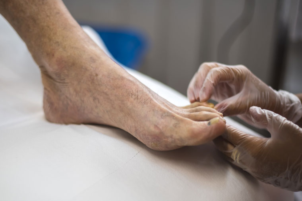 A podiatrist checks a senior patient's foot while touching the little toe.