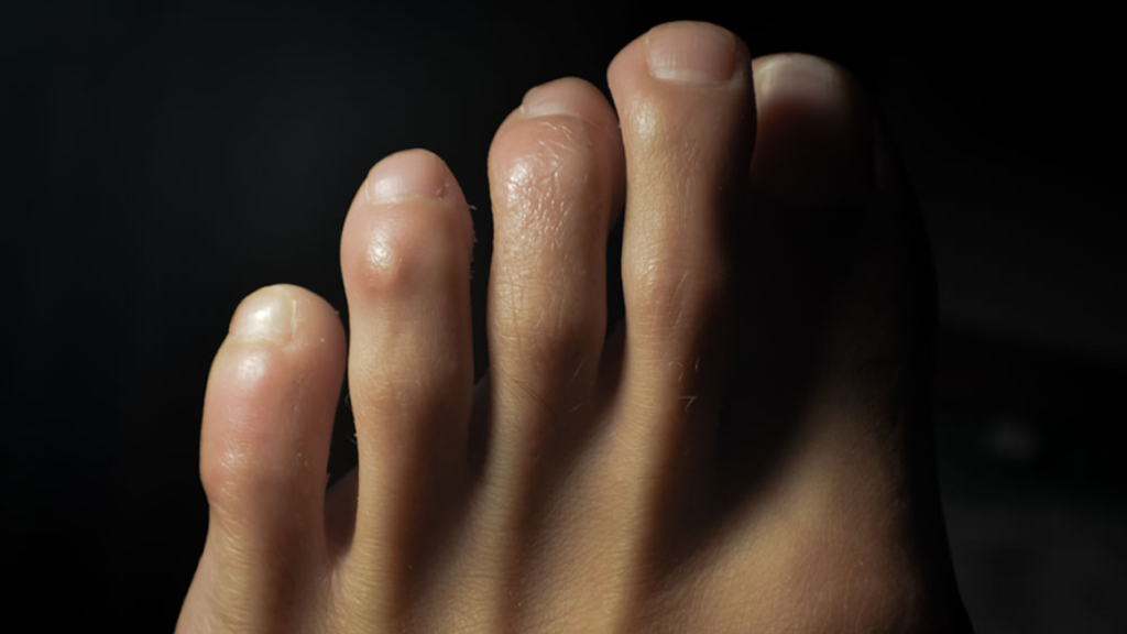 close up picture of a a foot