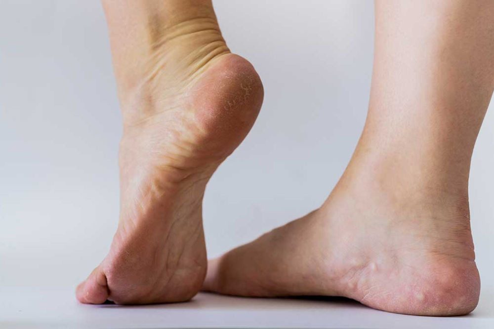 a foot with soft masses on it